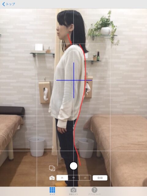 アクル整骨院 | 猫背矯正／29歳／女性／会社員／横浜市旭区在住 - 猫背矯正初診時
