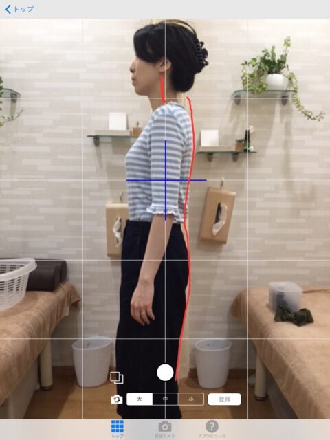 アクル整骨院 | 猫背矯正／29歳／女性／会社員／横浜市旭区在住 - 猫背矯正施術後