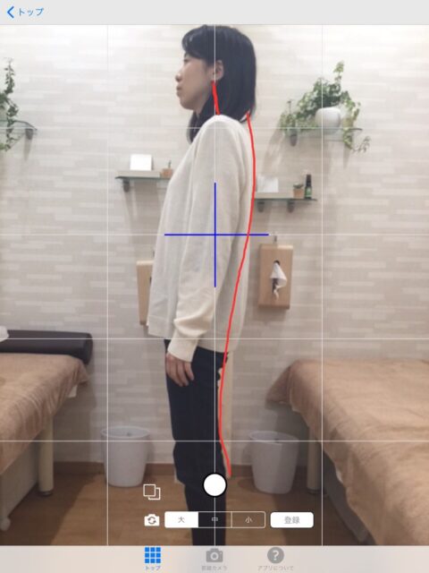 アクル整骨院 | 猫背矯正／29歳／女性／会社員／横浜市旭区在住 - 猫背矯正初回施術後