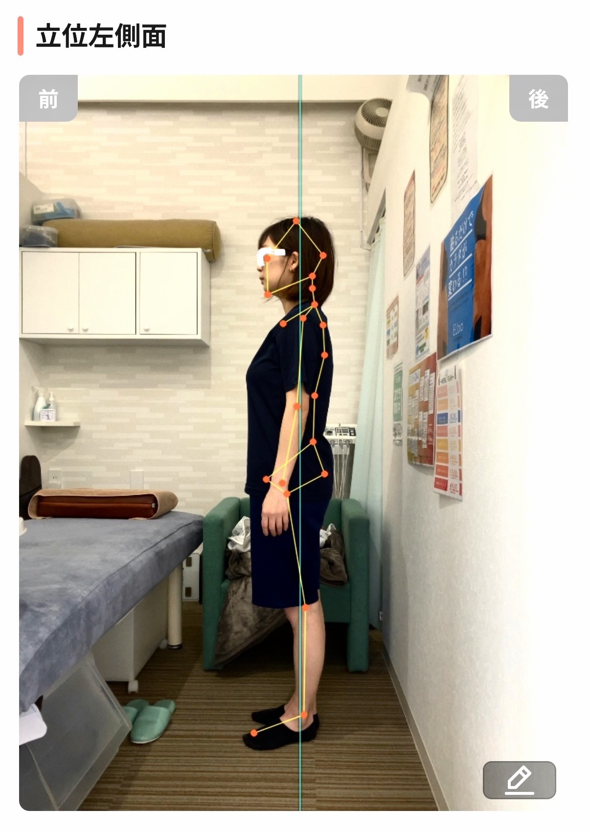 アクル整骨院 | 腰痛 アクル整骨院 | 腰痛 - AI姿勢分析おおのゆかビフォー横