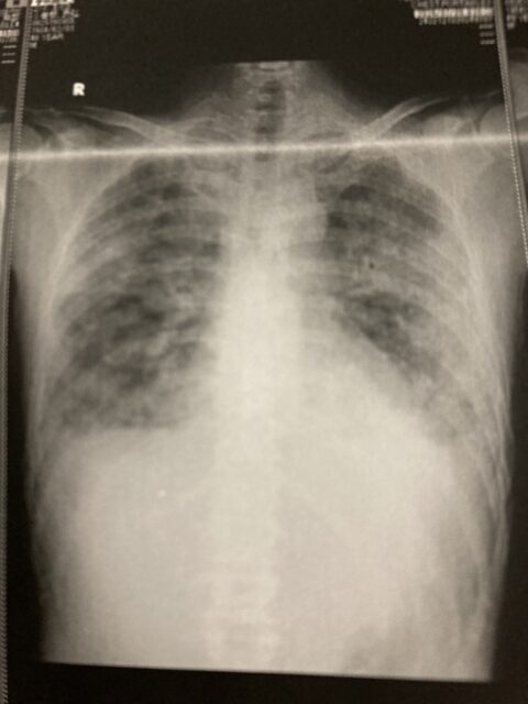 アクル整骨院 | 傷病日記③7/8(月)7/9(火) - IMG_6797