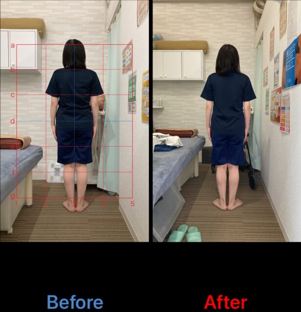 アクル整骨院 | 産後骨盤矯正　2025.4.21(月) - IMG_0108