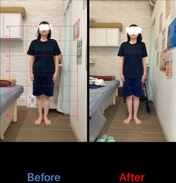 アクル整骨院 | 産後骨盤矯正　2025.4.21(月) - IMG_0110