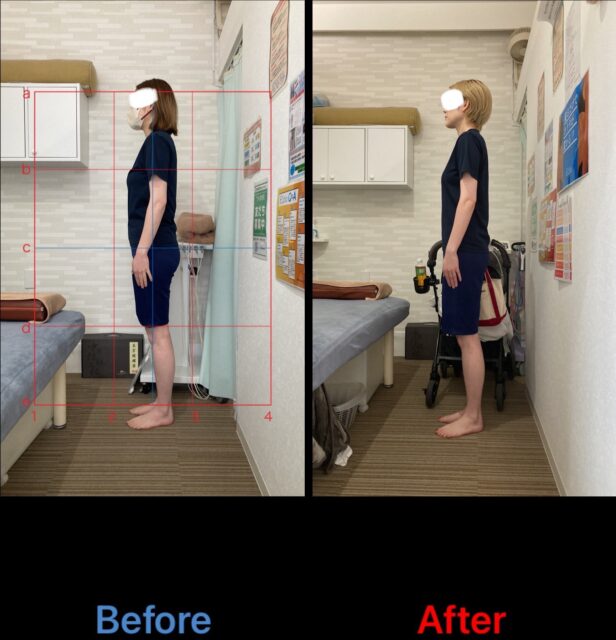 アクル整骨院 | 南町田在住/産後骨盤矯正／産後２か月／３３歳／女性／第二子出産／施術期間３か月半／ - IMG_1148