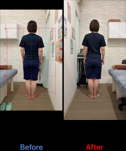 アクル整骨院 | 南町田在住/産後骨盤矯正／33歳女性／産後2か月／第一子出産／施術期間約3か月／ - 0548538e8ee7973d07f185a0297cce97-1062×1280