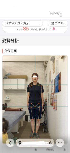 アクル整骨院 | 産後骨盤矯正／42歳女性／産後10か月／第3子出産／施術期間 約4か月／町田市小川在住 - 0c26585adeb17ae70b5de213119b0a7c-589×1280