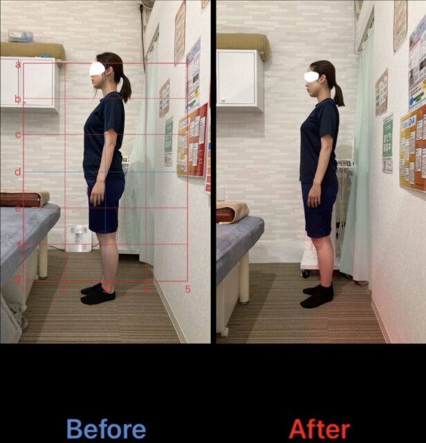 アクル整骨院 | 町田市鶴間在住/産後骨盤矯正/31歳女性/第二子出産/産後1か月/施術期間約4か月/ アクル整骨院 | 町田市鶴間在住/産後骨盤矯正/31歳女性/第二子出産/産後1か月/施術期間約4か月/ - 21e5c6ece0668483f22eedf407518a17-1232×1280