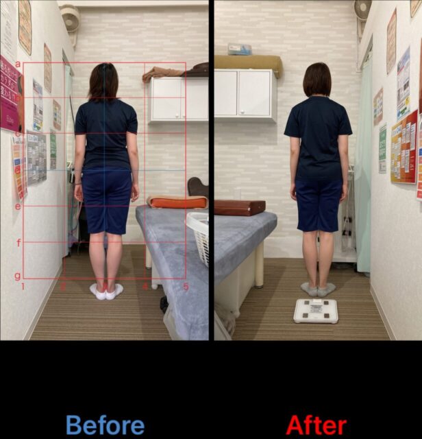 アクル整骨院 | 産後骨盤矯正／町田市金森在住/33歳女性／産後3か月／第1子出産／施術期間 約4か月 - 2289d07c4e738a21eb2fb9320b8d0abc-1232×1280