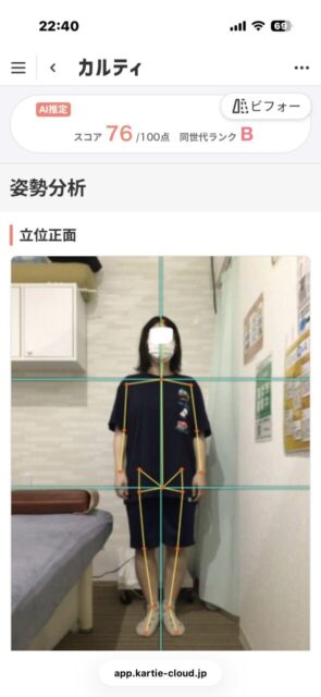 アクル整骨院 | 南町田在住/産後骨盤矯正/27歳女性/産後2か月/第1子出産/施術期間 約3か月/ アクル整骨院 | 南町田在住/産後骨盤矯正/27歳女性/産後2か月/第1子出産/施術期間 約3か月/ - 3fc63dab2c03b50900b3a6e10f8563e1-589×1280