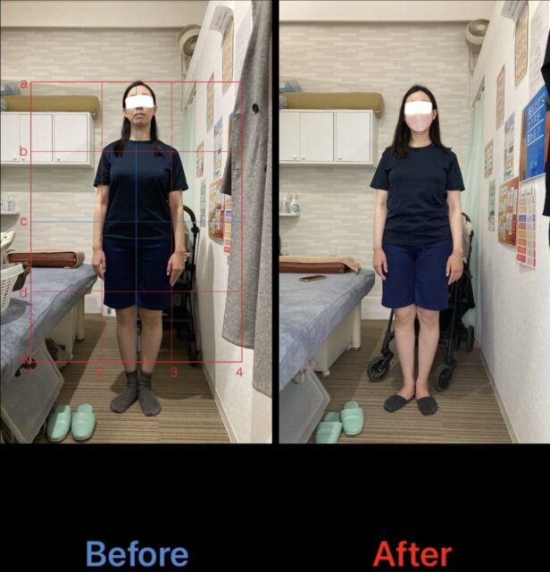 アクル整骨院 | 南町田在住/産後骨盤矯正/31歳女性/産後4か月/第一子出産/施術期間約4か月/ アクル整骨院 | 南町田在住/産後骨盤矯正/31歳女性/産後4か月/第一子出産/施術期間約4か月/ - 571c12793452c9375947b61eba0aa152-1232×1280