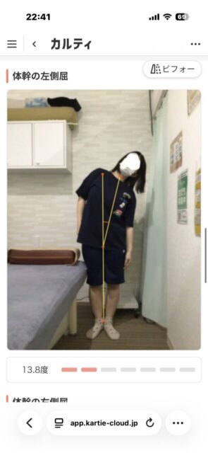 アクル整骨院 | 南町田在住/産後骨盤矯正/27歳女性/産後2か月/第1子出産/施術期間 約3か月/ アクル整骨院 | 南町田在住/産後骨盤矯正/27歳女性/産後2か月/第1子出産/施術期間 約3か月/ - 58df14c37534d1554b478ba754b8bb5d-589×1280