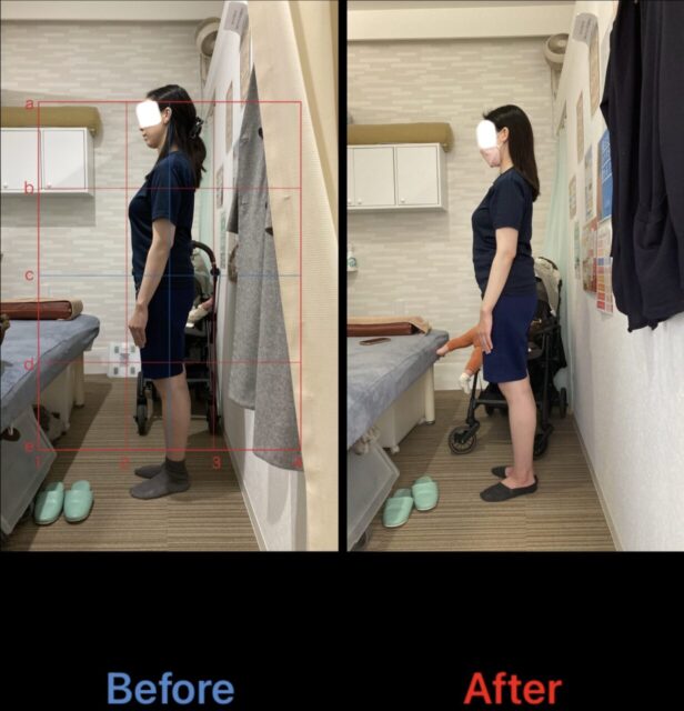 アクル整骨院 | 南町田在住/産後骨盤矯正/31歳女性/産後4か月/第一子出産/施術期間約4か月/ アクル整骨院 | 南町田在住/産後骨盤矯正/31歳女性/産後4か月/第一子出産/施術期間約4か月/ - 62382382418ccdbab66299ca6be8c68b-1232×1280