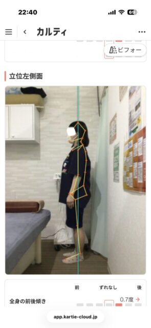 アクル整骨院 | 南町田在住/産後骨盤矯正/27歳女性/産後2か月/第1子出産/施術期間 約3か月/ アクル整骨院 | 南町田在住/産後骨盤矯正/27歳女性/産後2か月/第1子出産/施術期間 約3か月/ - 8248c07183b9542b610e38b868e85004-589×1280