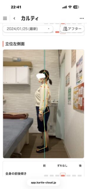 アクル整骨院 | 南町田在住/産後骨盤矯正/27歳女性/産後2か月/第1子出産/施術期間 約3か月/ アクル整骨院 | 南町田在住/産後骨盤矯正/27歳女性/産後2か月/第1子出産/施術期間 約3か月/ - 9338406fb412373b38ce1715a8a8cc2e-589×1280