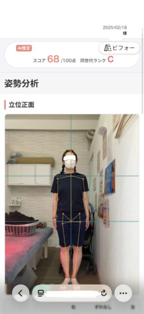 アクル整骨院 | 産後骨盤矯正／42歳女性／産後10か月／第3子出産／施術期間 約4か月／町田市小川在住 - b83b36364d9261f762a387a1a26eb123-589×1280