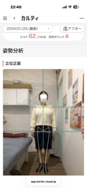 アクル整骨院 | 南町田在住/産後骨盤矯正/27歳女性/産後2か月/第1子出産/施術期間 約3か月/ アクル整骨院 | 南町田在住/産後骨盤矯正/27歳女性/産後2か月/第1子出産/施術期間 約3か月/ - dc299fef28bd8b9b4e86452c9a920d97-589×1280