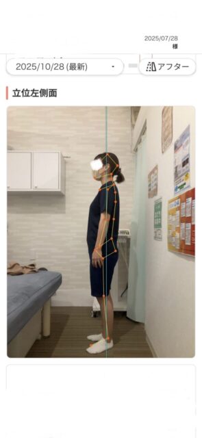 アクル整骨院 | 町田市南町田在住／産後骨盤矯正／産後1か月／第2子出産／33歳女性／施術期間 約3か月／ - e25a55b0431bbcc71c0c36be04acb14e-589×1280