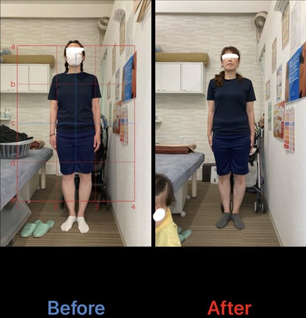 アクル整骨院 | 産後骨盤矯正／42歳女性／産後10か月／第3子出産／施術期間 約4か月／町田市小川在住 - f87640633e614f8d835a19cc96f747f0-1232×1280