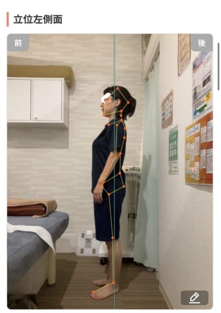 アクル整骨院 | 町田市南つくし野在住／産後2か月／第2子出産／36歳女性／施術期間 約3か月 - 6822a2bd7c12124e88bd6914ba17cb38-902×1280