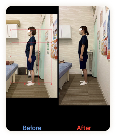 アクル整骨院 | トップ アクル整骨院 | トップ - Results-item (4)