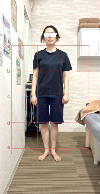 アクル整骨院 | 産後1か月／町田市金森在住/30歳女性／第2子出産／施術期間 約4か月 - 15686be1eeb84be13837737a6959e730-660×1280