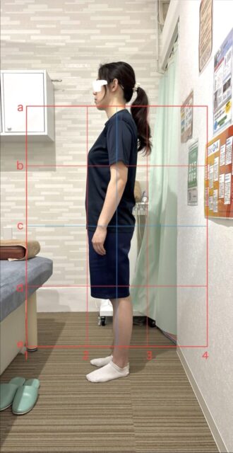 アクル整骨院 | 産後1か月／町田市金森在住/30歳女性／第2子出産／施術期間 約4か月 - 3df43693c9af2772b1c86c8cf657dea0-660×1280