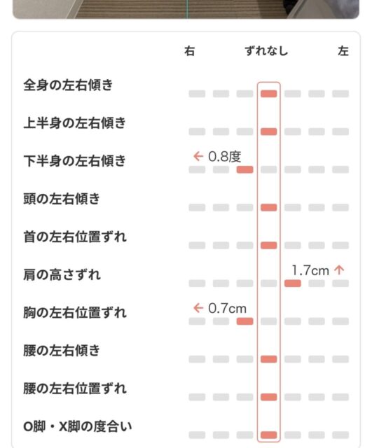 アクル整骨院 | 町田市鶴間在住/産後骨盤矯正/産後6か月/第1子出産/27歳女性/施術期間 約3か月 アクル整骨院 | 町田市鶴間在住/産後骨盤矯正/産後6か月/第1子出産/27歳女性/施術期間 約3か月 - Screenshot