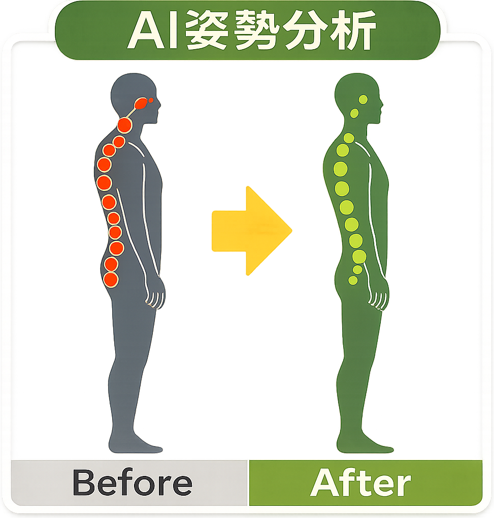 アクル整骨院 | 料金･施術の流れ - AI姿勢分析