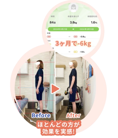 アクル整骨院 | 産後骨盤矯正 - 7966bae78213db11914ad7af893f8431-removebg-preview