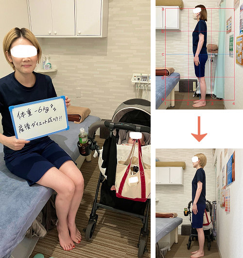 アクル整骨院 | 産後骨盤矯正 - Image-Area