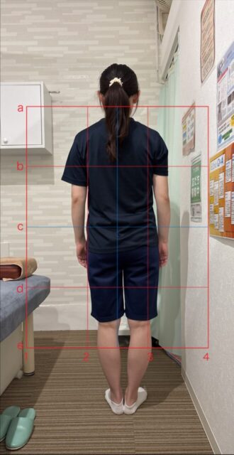 アクル整骨院 | 産後1か月／町田市金森在住/30歳女性／第2子出産／施術期間 約4か月 - a38d561e988bc3ab4ee3434f6b942715-660×1280