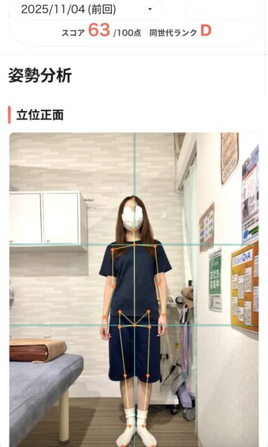 アクル整骨院 | 町田市鶴間在住/産後骨盤矯正/産後6か月/第1子出産/27歳女性/施術期間 約3か月 アクル整骨院 | 町田市鶴間在住/産後骨盤矯正/産後6か月/第1子出産/27歳女性/施術期間 約3か月 - ab67b75872c6bd38d98e87af9e222f7e-768×1280