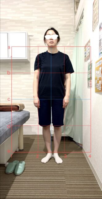 アクル整骨院 | 産後1か月／町田市金森在住/30歳女性／第2子出産／施術期間 約4か月 - f67f87f74f0a9dbb207238ef3b7e4785-660×1280