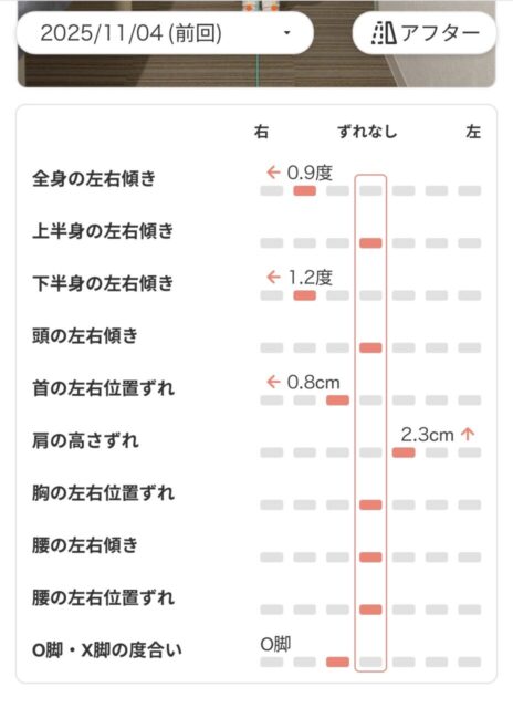 アクル整骨院 | 町田市鶴間在住/産後骨盤矯正/産後6か月/第1子出産/27歳女性/施術期間 約3か月 アクル整骨院 | 町田市鶴間在住/産後骨盤矯正/産後6か月/第1子出産/27歳女性/施術期間 約3か月 - Screenshot